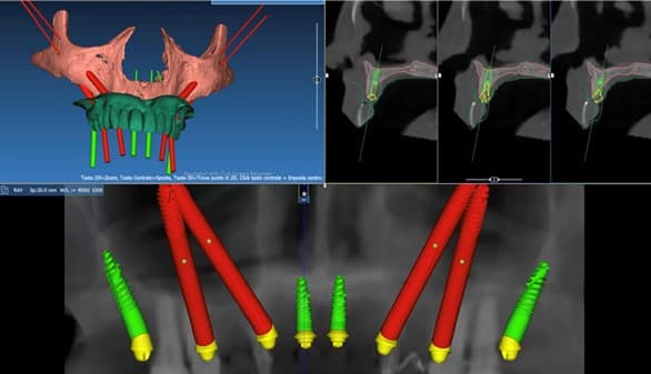 teeth xray
