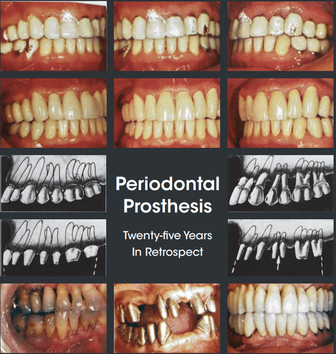 teeth xray