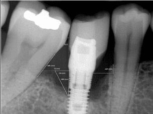 teeth xray