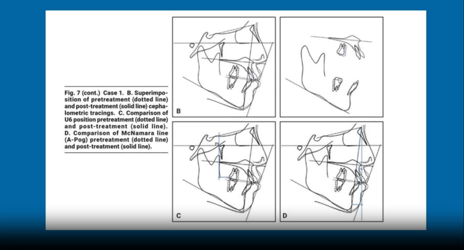 course image