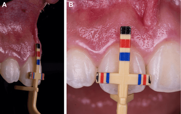 teeth xray