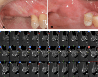 teeth xray