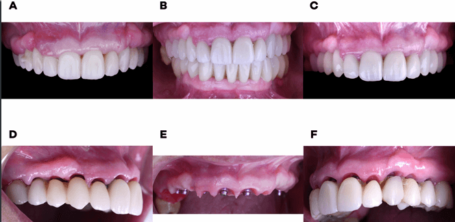 teeth xray