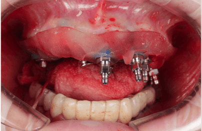 teeth xray