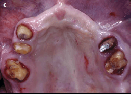 teeth xray