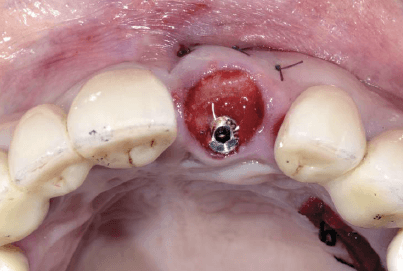 teeth xray