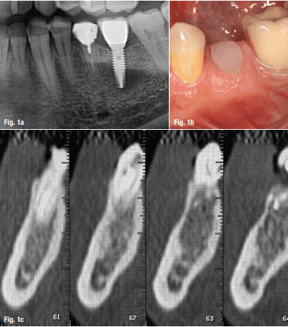 teeth xray