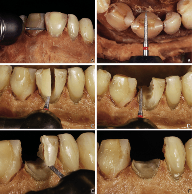 teeth xray