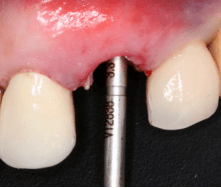 teeth xray