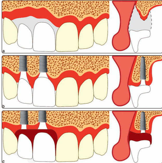 teeth xray