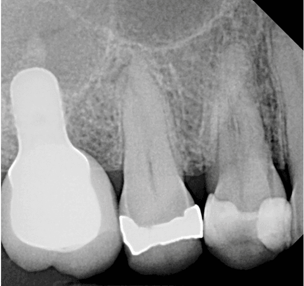 teeth xray