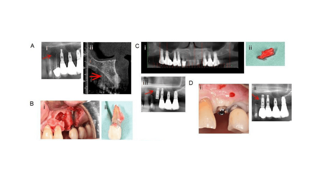 teeth xray