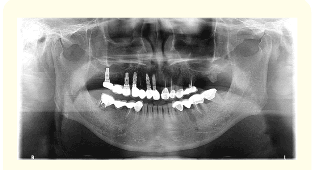 teeth xray