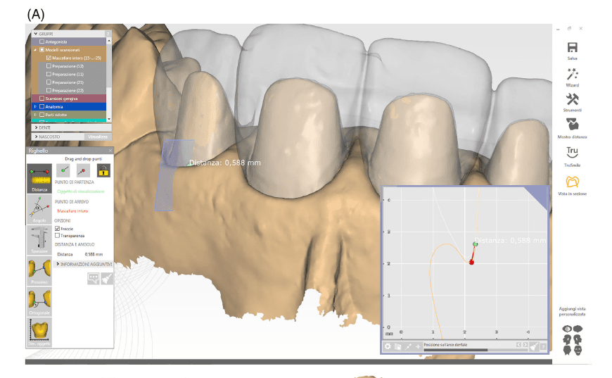 teeth xray