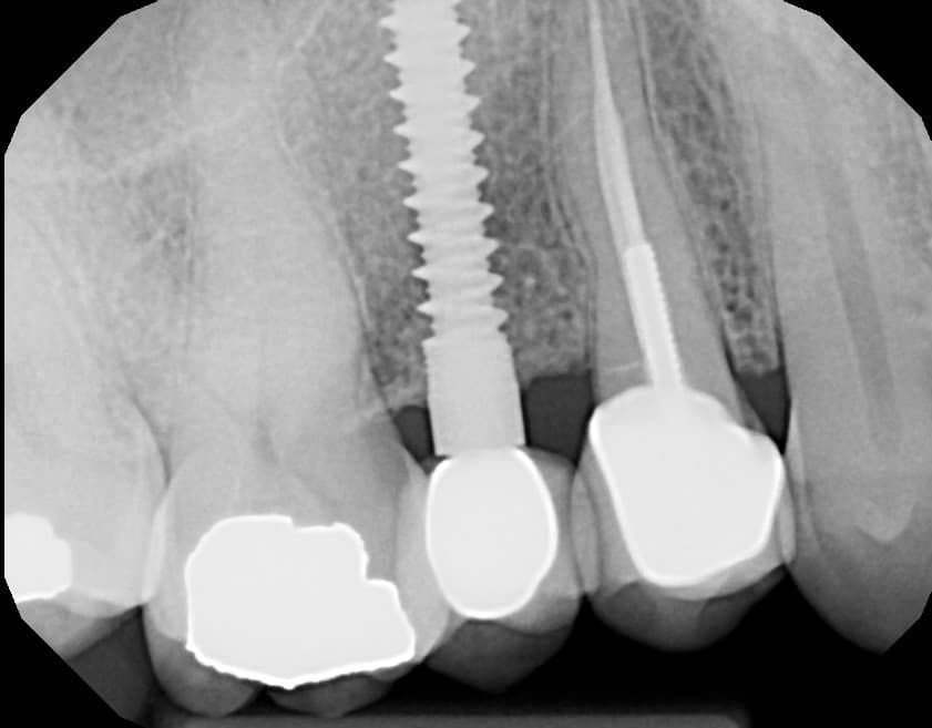is-content-caseimages--1069-X09910_4.JPG