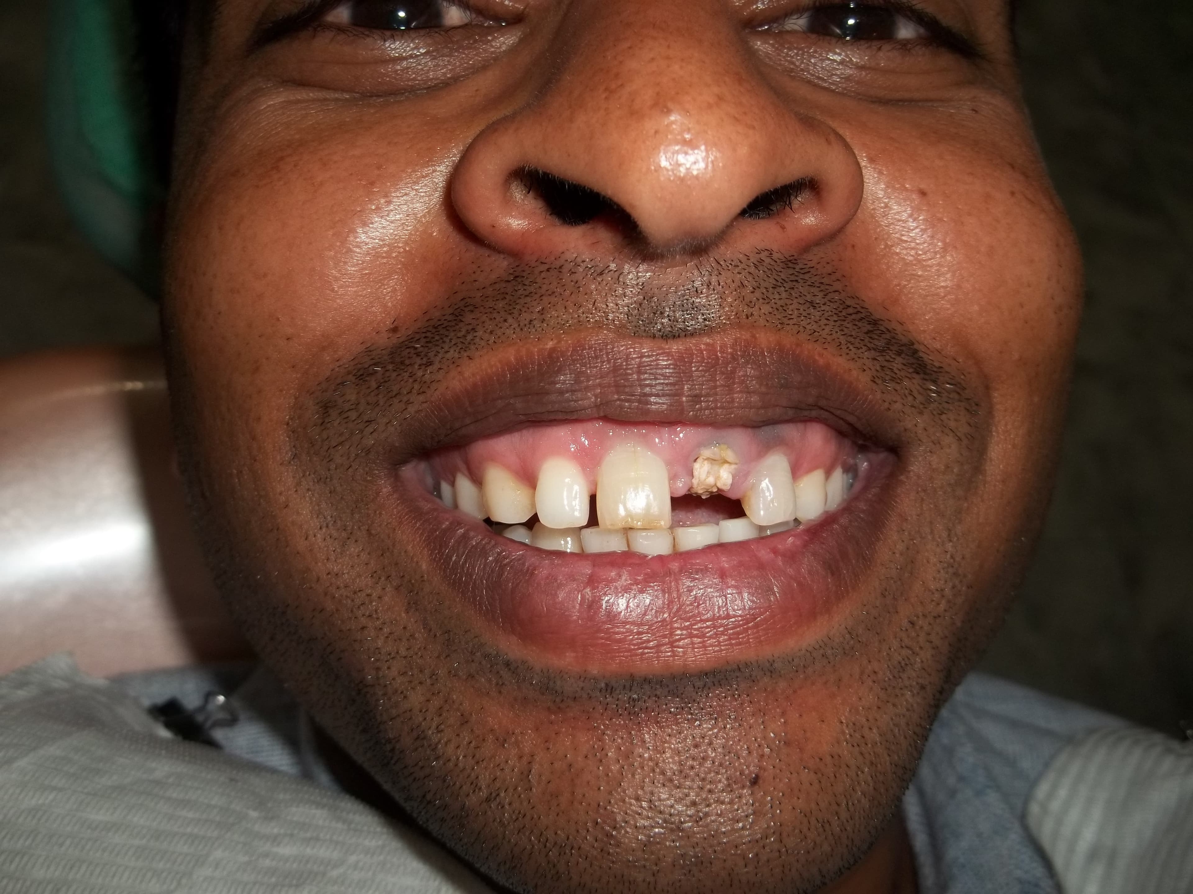 is-content-caseimages--1079-100_2963.JPG