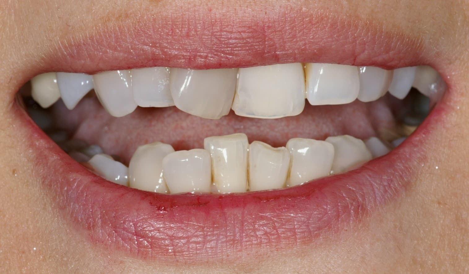 is-content-caseimages--3860-2_preop clinicals3.jpg