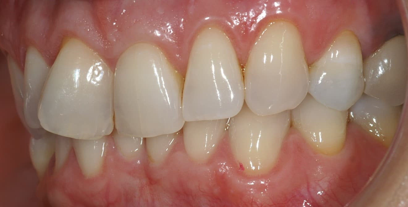 is-content-caseimages--3860-3_preop clinicals13.jpg