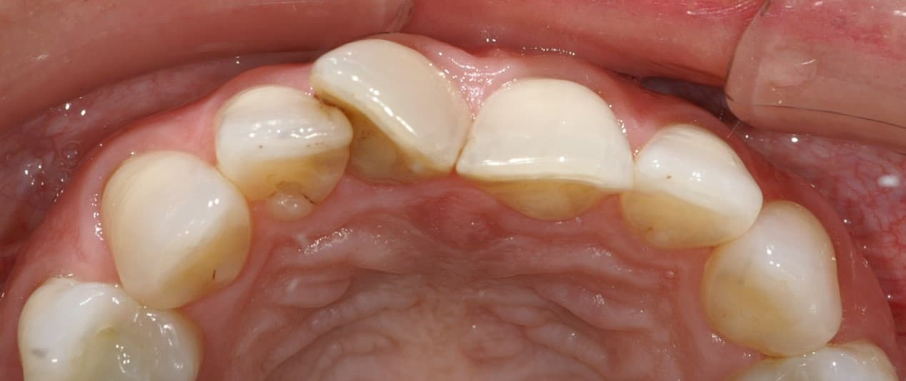 is-content-caseimages--3860-4_preop clinicals19.jpg