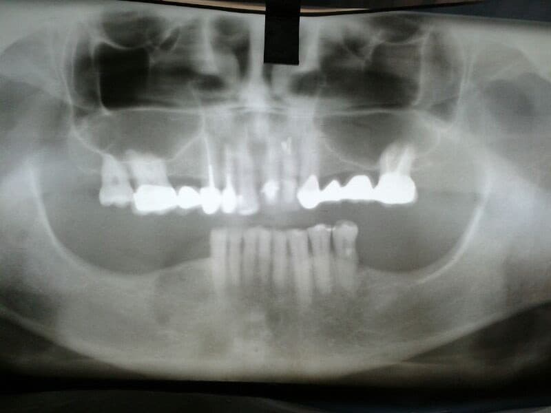is-content-caseimages--900-IMG_0444.JPG