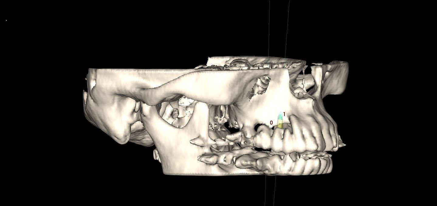 is-content-caseimages--963-3d image3D.jpg
