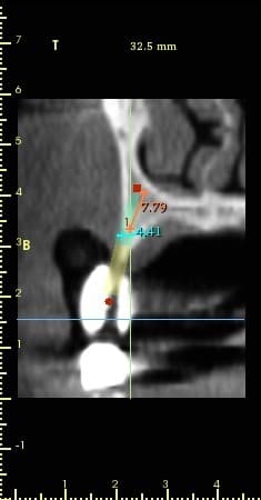 is-content-caseimages--963-3d imageSequential 3.jpg