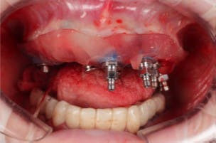 teeth xray