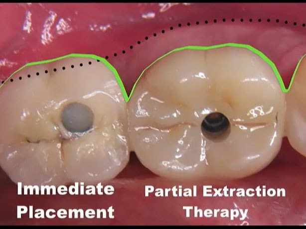 webinar-image