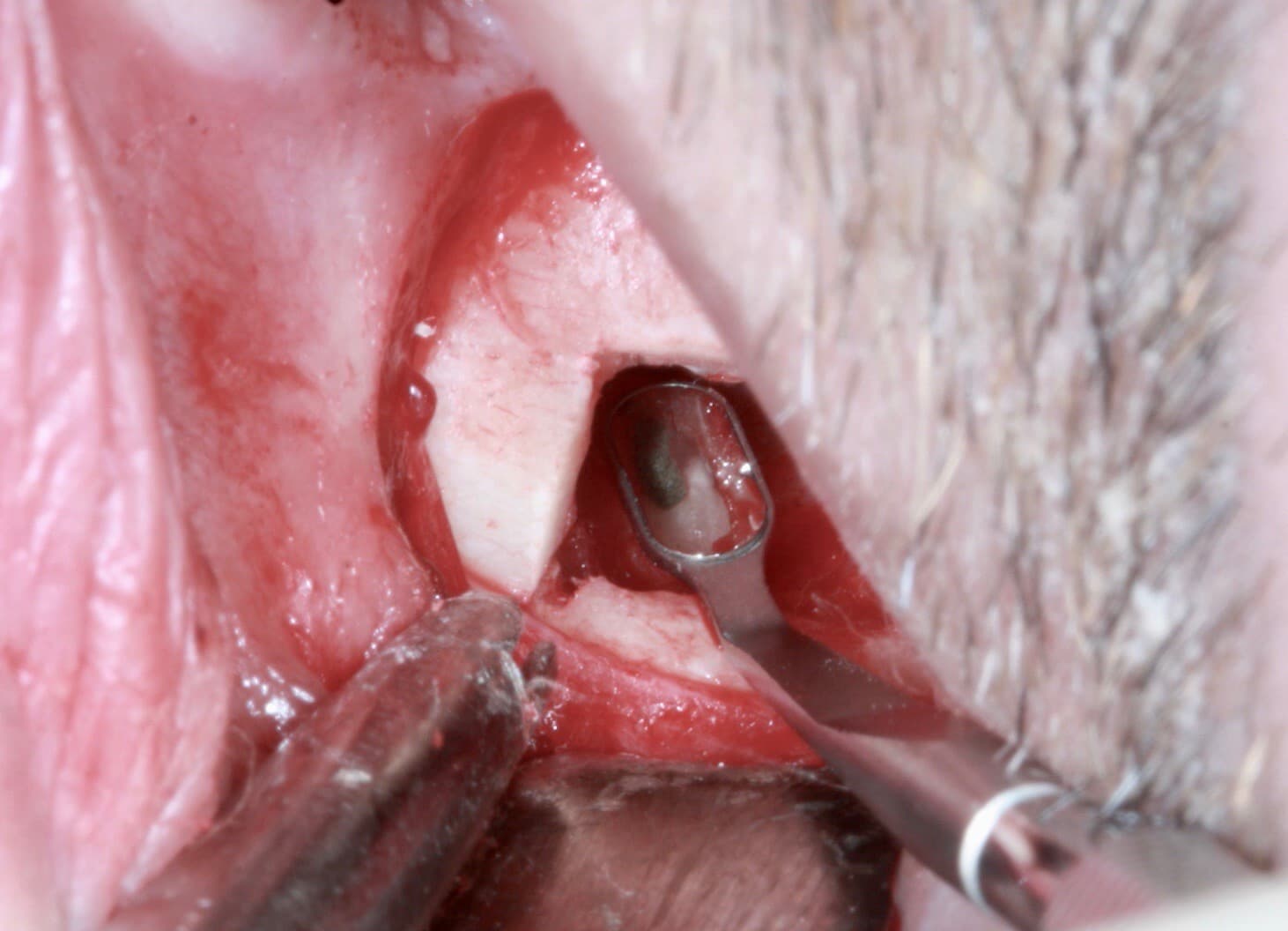 is-content-caseimages--7476-3_Apicoectomy 37 %2D 2.jpg